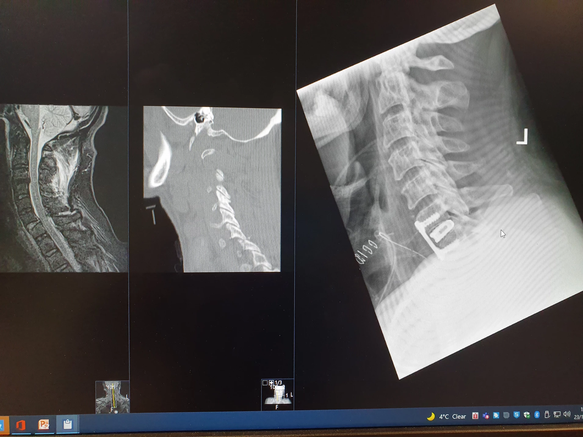 Challenging cases