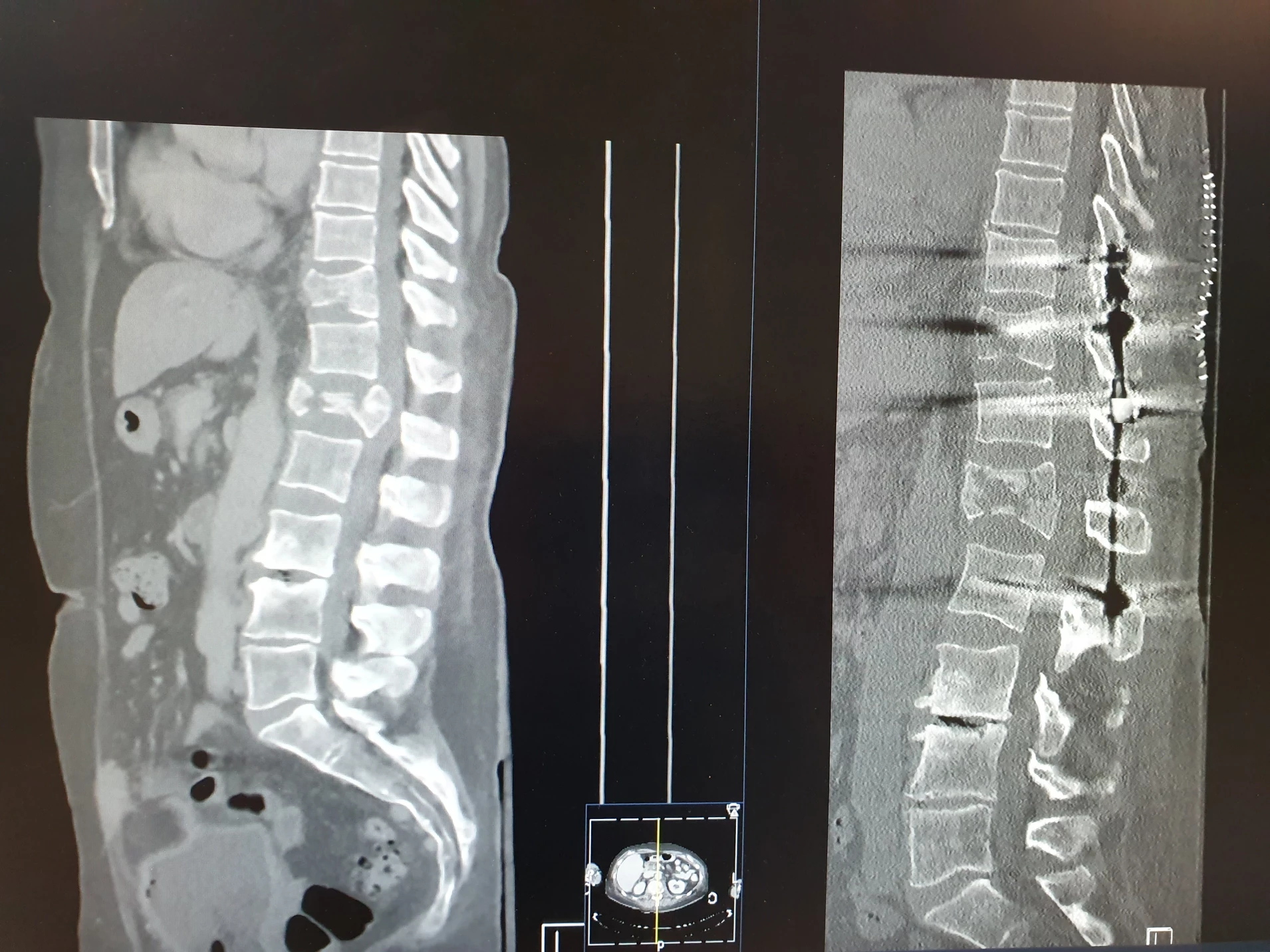 Challenging cases