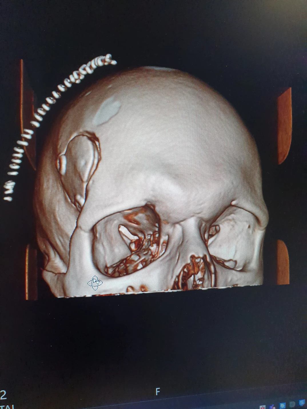 Challenging cases