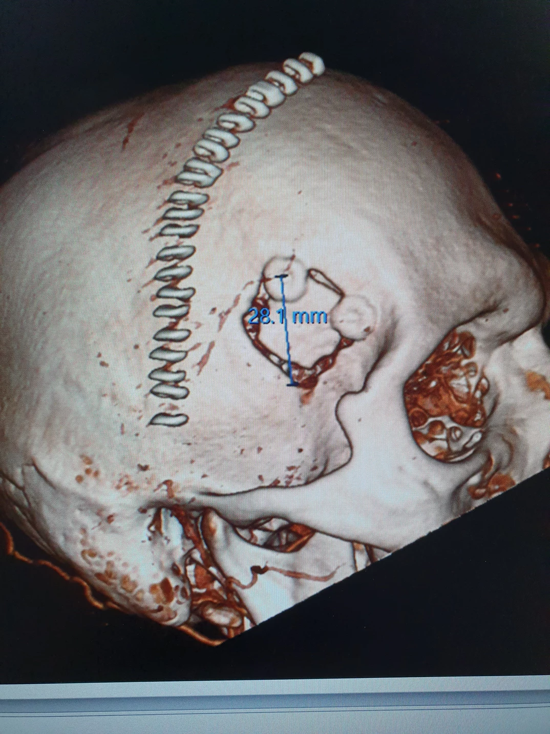 Challenging cases