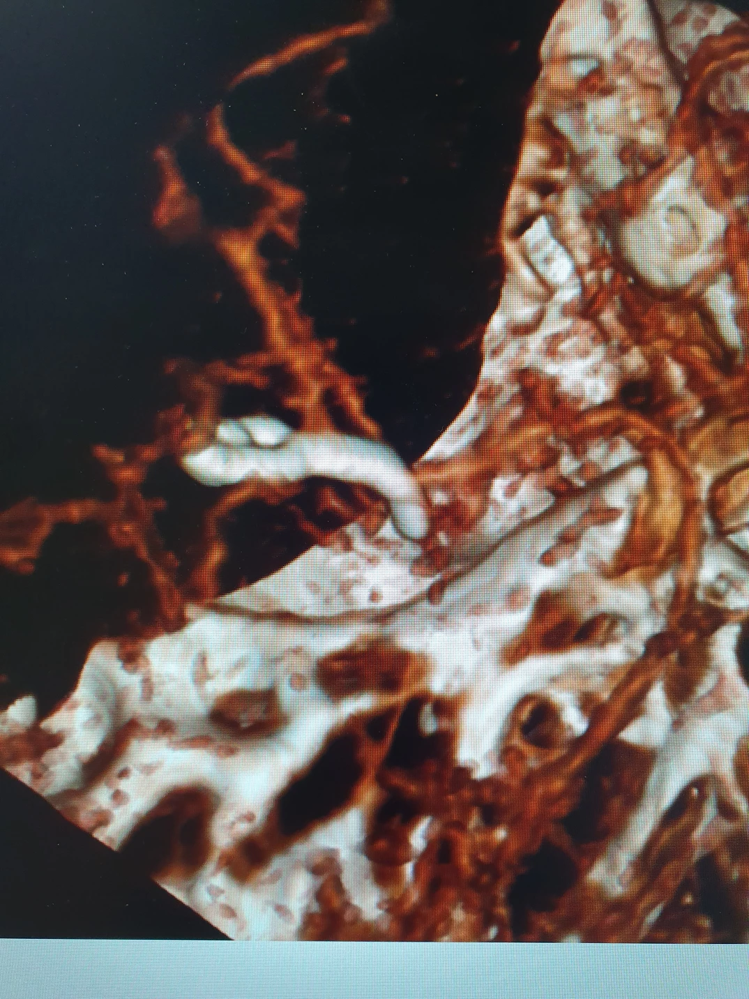 Challenging cases