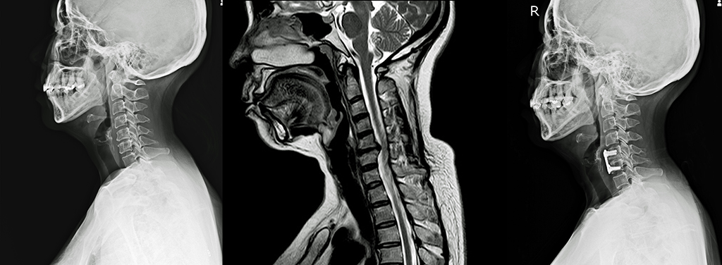 Neck Pain | The Importance of Proper Diagnosis